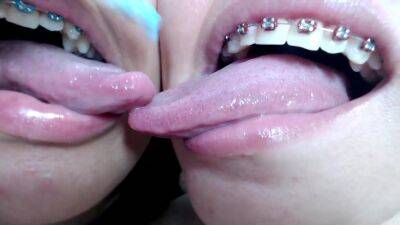 Deep tounge kissing between two brace lesbian on vidfreenow.com