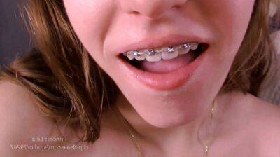 Blow it on my braces on vidfreenow.com